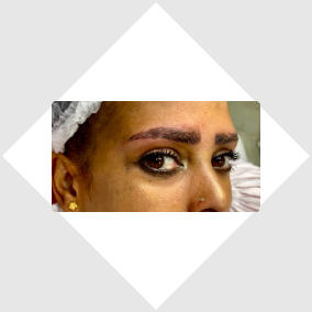 Eybrow before and after